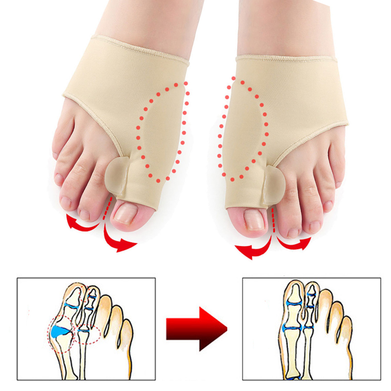 Big Toe Bunion Corrector Splint for Valgus Pain Relief – Orthopedic Silicone Braces, Pedicure Socks & Toes Separator for Effective Foot Care