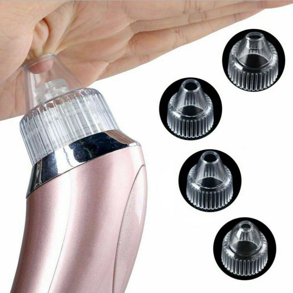 Electric Blackhead Vacuum Pore Cleaner - Strong Suction Acne & Pimple Remover Tool, Diamond Dermabrasion Face Cleaner