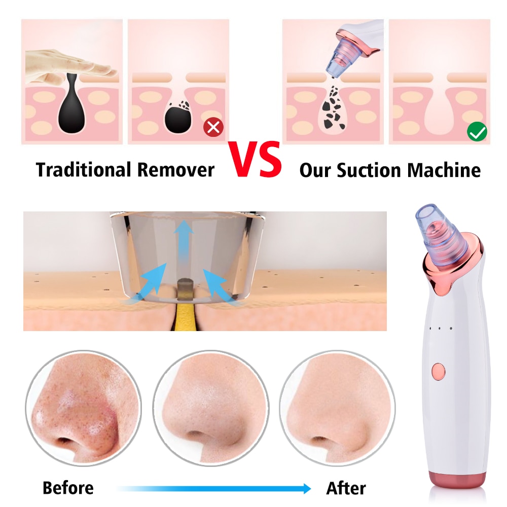 Electric Blackhead Suction Instrument - Facial Washing Device for Acne Cleaning and Beauty