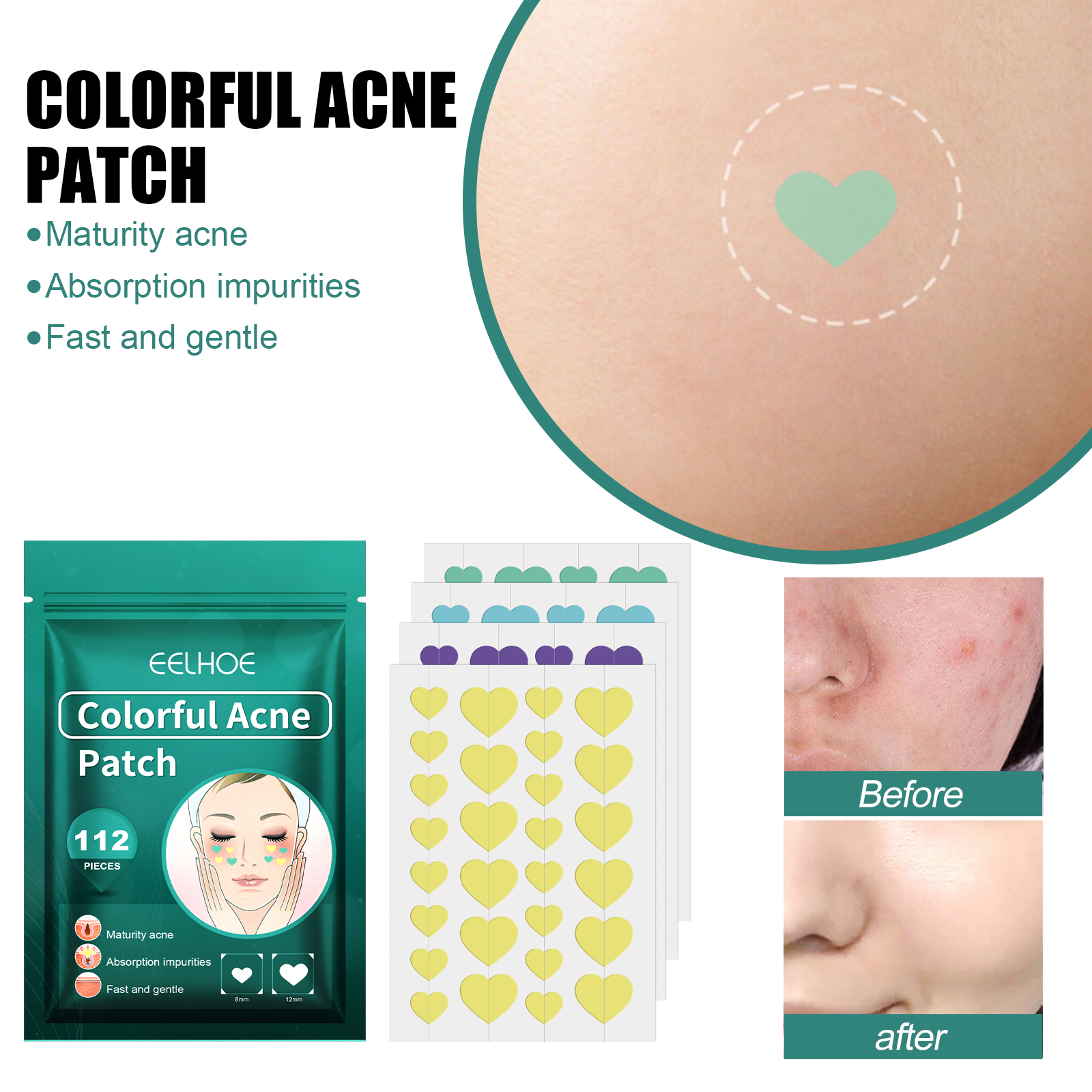 EELHOE Love Acne Patch - Gentle Cleansing Acne Patch for Fading Facial Acne Marks and Spots, Essential Cleansing Care