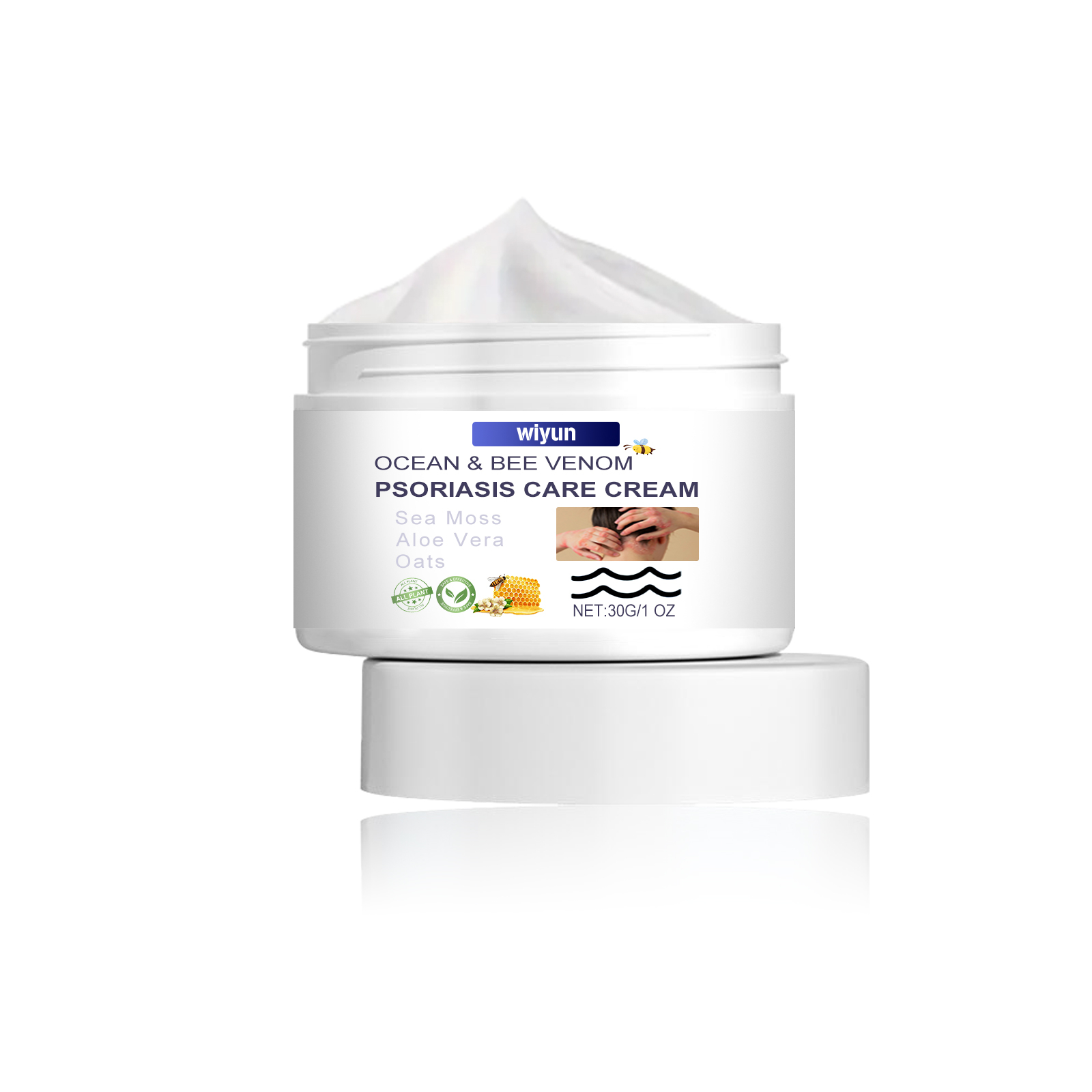 Effective Psoriasis Care Cream for Soothing Relief and Healthy Skin