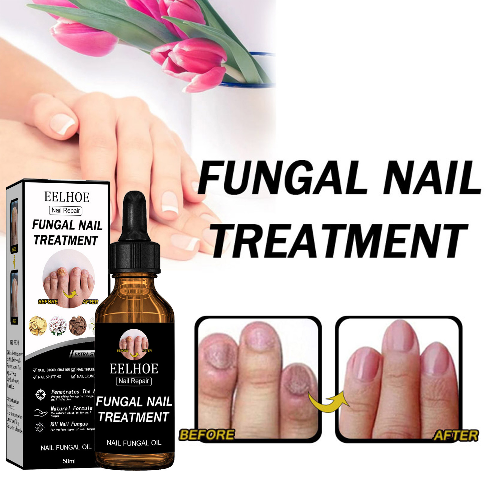 EELHOE Nail Repair Solution for Thickening, Shining, and Moisturizing Care - Dead Skin Removal & Nutritional Repair Liquid