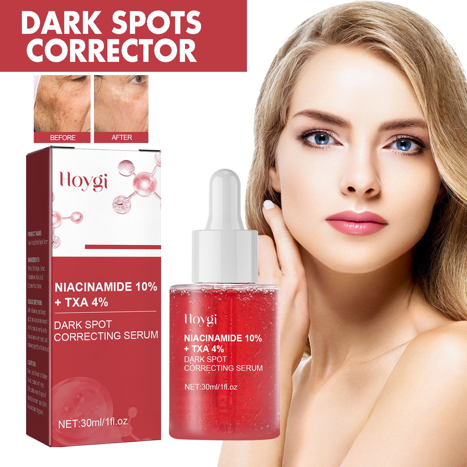 Hoygi Black Spot Repair Essence - Brightening & Moisturizing Solution for Black and Age Spots