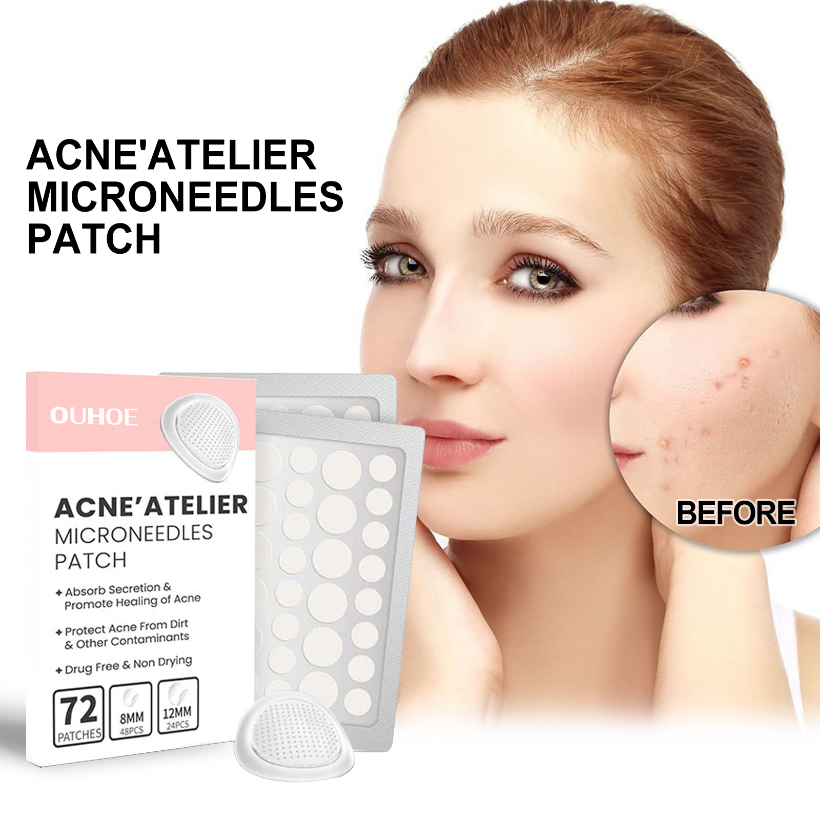 OUHOE Acne Patch - Repair Acne, Reduce Redness, Cleanse Pores & Moisturize
