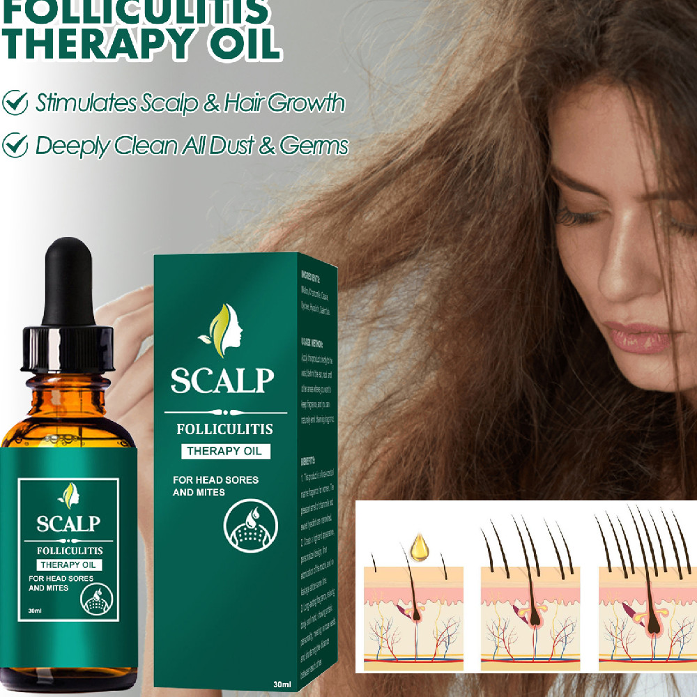 Revitalize Your Hair with Scalp Deep Cleansing Recovery Oil
