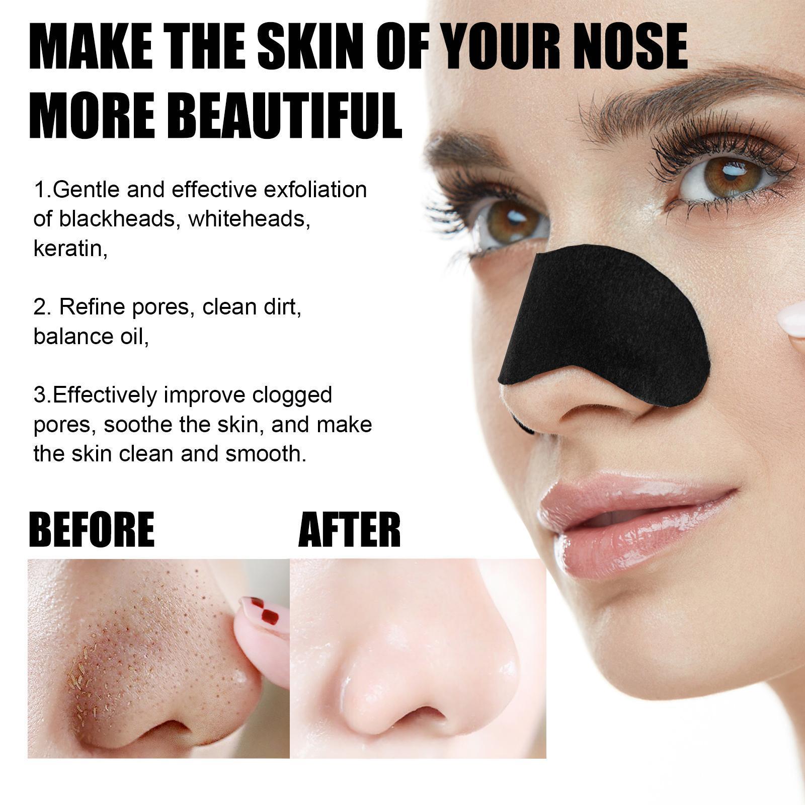 10 Pcs Blackhead Nose Patches - Deep Cleansing Pore Strips for Men & Women