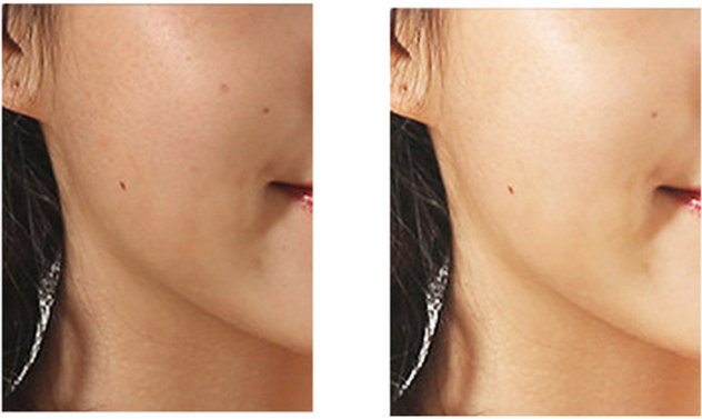 Mini Rotating Pore Cleansing Brush for Deep Facial Cleanse and Care - Image 5