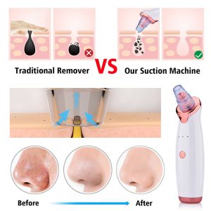 Electric Blackhead Suction Instrument - Facial Washing Device for Acne Cleaning
