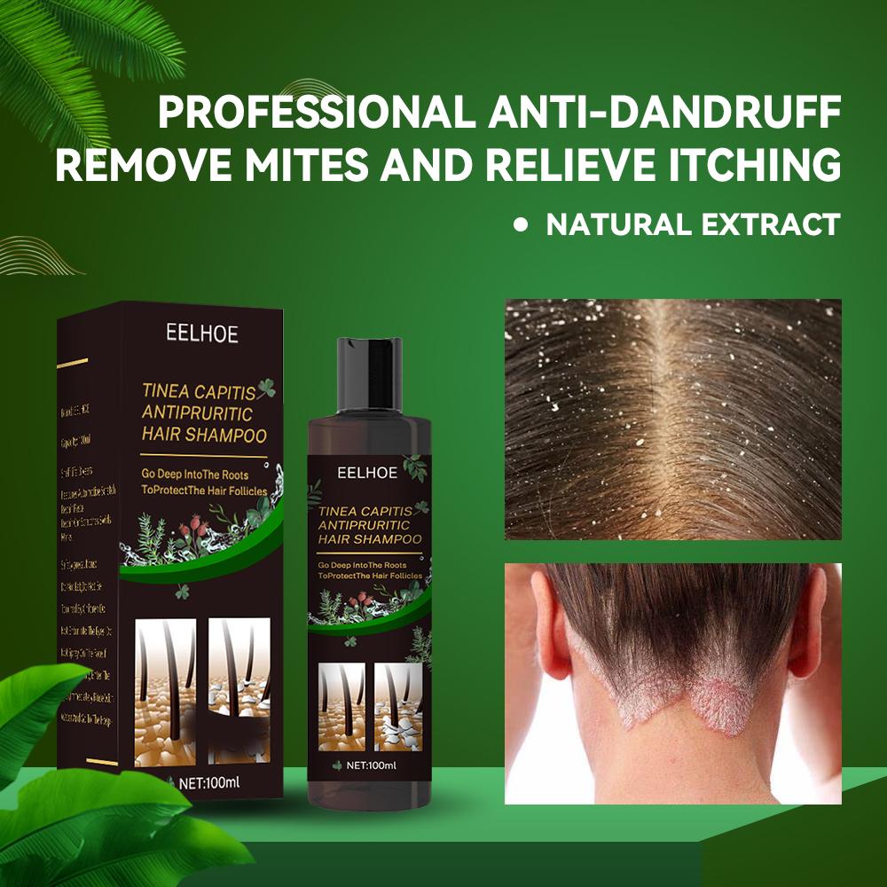 EELHOE Anti-Dandruff Shampoo - Soothing Itch Relief, Hair Loss Prevention, Oil Control & Refreshing Care - Image 3