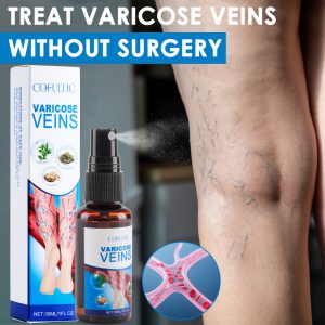 30ml Varicose Vein Spray - Multi-Purpose Knee & Leg Care to Enhance Blood Circulation